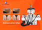 CE Approved 6 In 1 Ultrasonic Cavitation Slimming Machine Wind And Water Cooling System